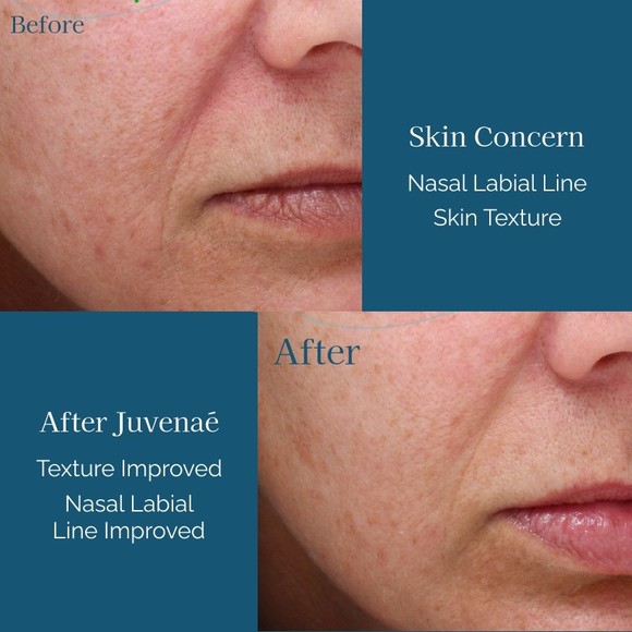 Juvenae Skincare Anti Aging Cream Moisturizer Wrinkles Sunspot Tightness New $60 - Picture 6 of 7